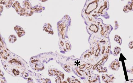 A Novel Technique to Estimate Intravillous Fetal Vasculature on Routine Placenta Sections